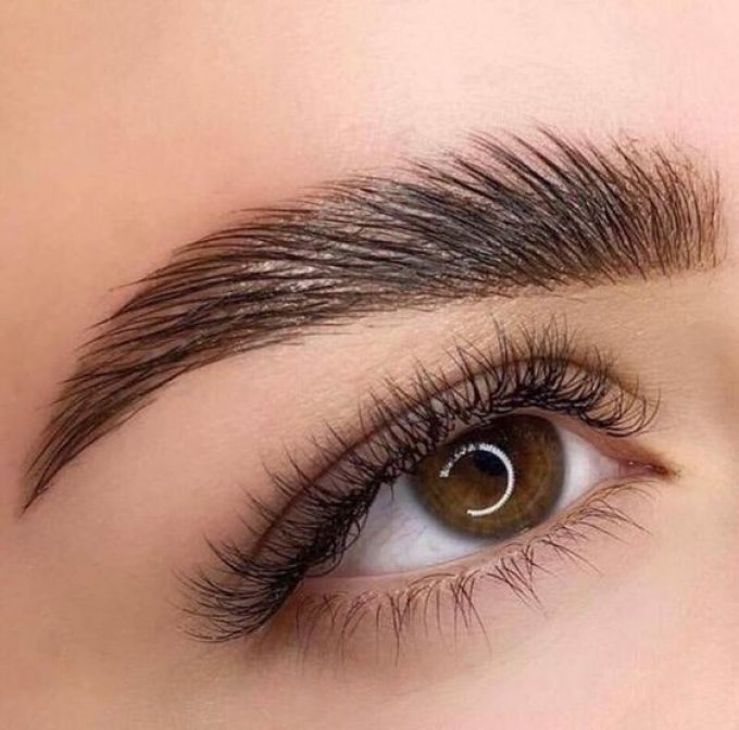 Brow Lift