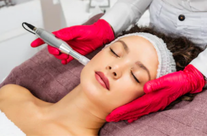 Microneedling