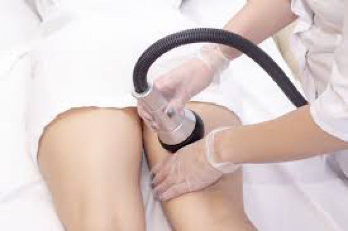 Lipocavitation - Corps (par zone)